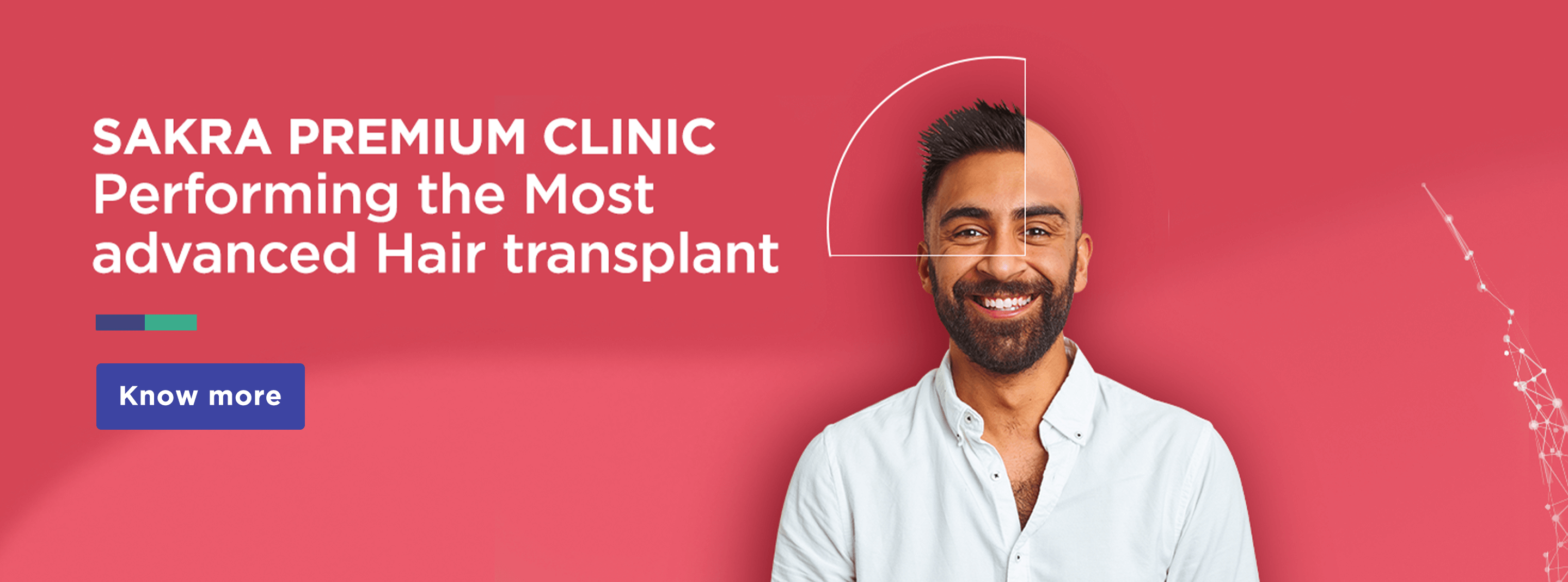 Hair Transplant Clinic in Bangalore | Hair Transplant in Bangalore | Sakra  Premium Clinic
