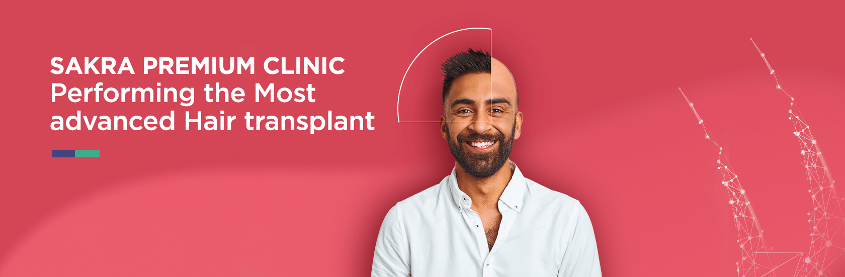 Best Hair Transplant Clinic UK - Hair Transplant Istanbul - Hair Transplant  Clinic Turkey - Professional Hair Transplant Treatment - BlueMagic Group